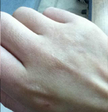 的脸第十期：秋冬护手困扰AG真人登录入口救救我(图3)